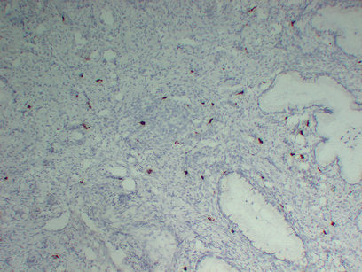 Anti-Mast Cell Tryptase Mouse Monoclonal Antibody