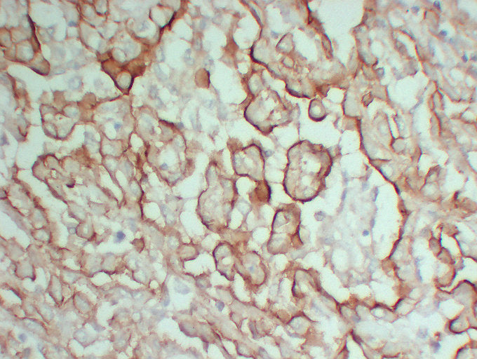 Anti-Mucin 16 Mouse Monoclonal Antibody