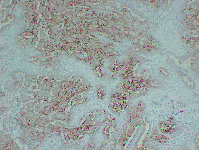 Anti-Mucin 16 Mouse Monoclonal Antibody