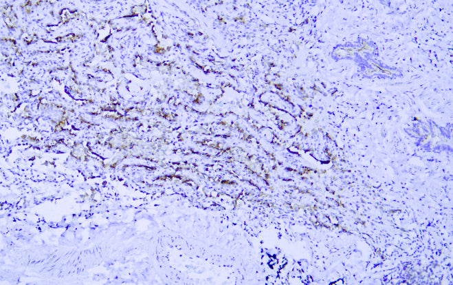 Anti-Mucin 4 Mouse Monoclonal Antibody