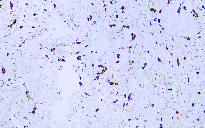 Anti-NAPSIN A Mouse Monoclonal Antibody