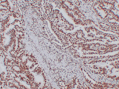 Anti-Nucleophosmin Mouse Monoclonal Antibody