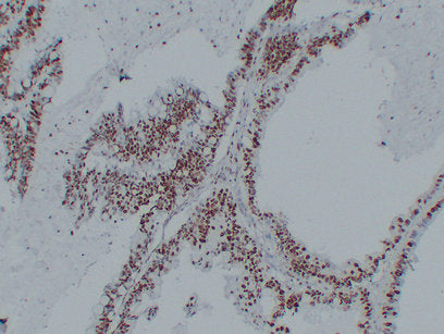 Anti-Nucleophosmin Mouse Monoclonal Antibody