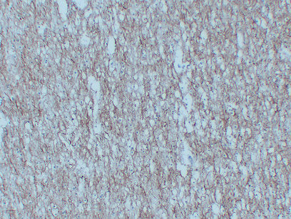 Anti-Neurofilament Light Polypeptide Mouse Monoclonal Antibody