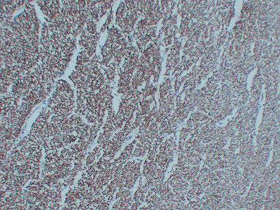 Anti-Neurofilament Light Polypeptide Mouse Monoclonal Antibody