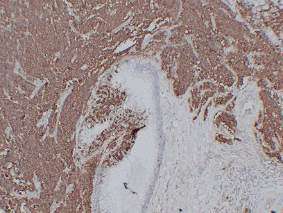 Anti-NCAM1 Mouse Monoclonal Antibody