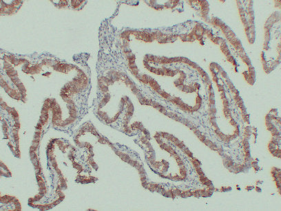 Anti-N Cadherin Mouse Monoclonal Antibody