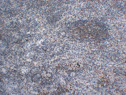 Anti-Oct-2 Mouse Monoclonal Antibody