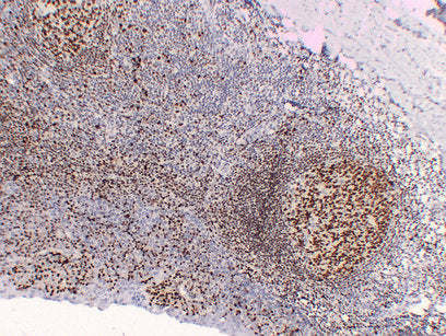 Anti-Oct-2 Mouse Monoclonal Antibody