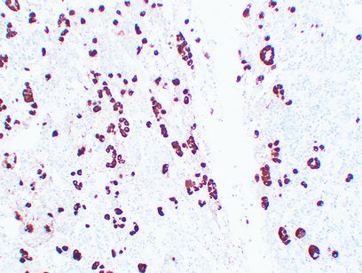 Anti-POMC Mouse Monoclonal Antibody