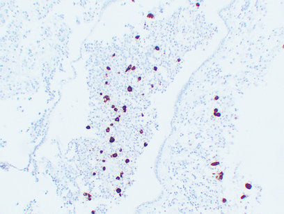 Anti-POMC Mouse Monoclonal Antibody
