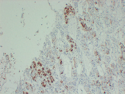 Anti-Prolactin Mouse Monoclonal Antibody