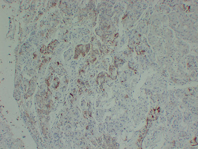 Anti-Prolactin Mouse Monoclonal Antibody