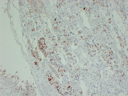 Anti-Prolactin Mouse Monoclonal Antibody