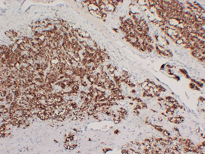 Anti-Parathyroid Hormone Mouse Monoclonal Antibody