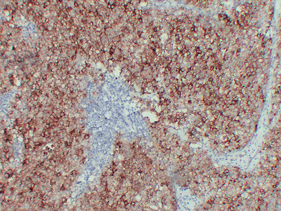 Anti-Placental Alkaline Phosphatase Mouse Monoclonal Antibody