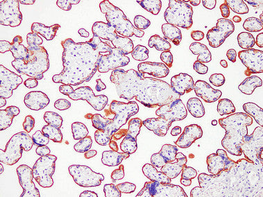 Anti-Placental Alkaline Phosphatase Mouse Monoclonal Antibody