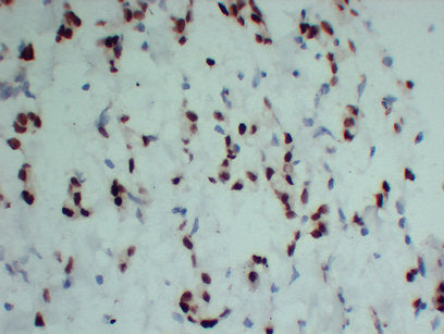 Anti-Progesterone Receptor Mouse Monoclonal Antibody