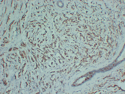 Anti-Progesterone Receptor Mouse Monoclonal Antibody