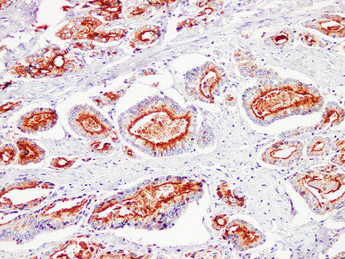 Anti-Prostate Specific Antigen Mouse Monoclonal Antibody