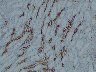 Anti-PGP9.5 Mouse Monoclonal Antibody