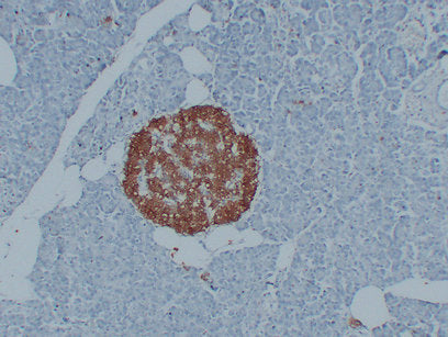 Anti-PGP9.5 Mouse Monoclonal Antibody
