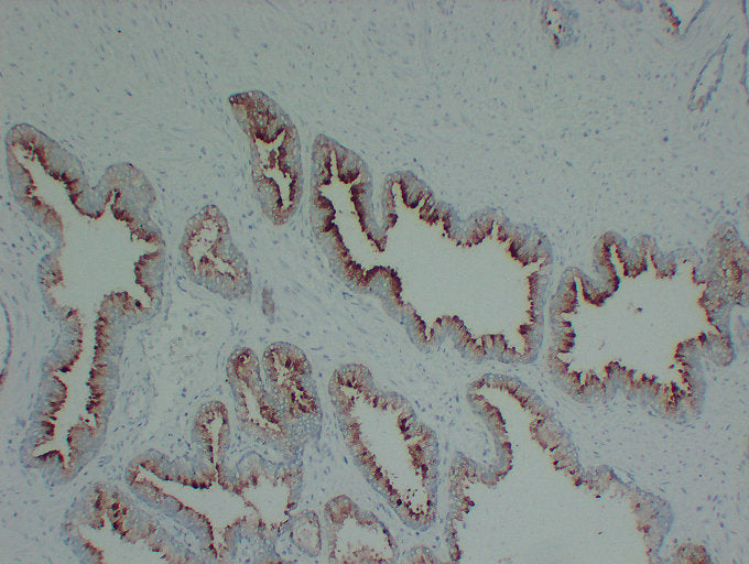 Anti-Prostatic Acid Phosphatase Mouse Monoclonal Antibody