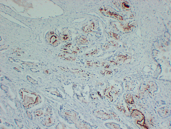 Anti-Prostatic Acid Phosphatase Mouse Monoclonal Antibody
