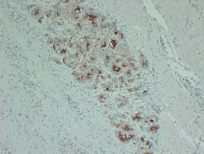 Anti-PI3 Kinase p110 alpha Mouse Monoclonal Antibody
