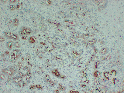 Anti-PI3 Kinase p110 alpha Mouse Monoclonal Antibody