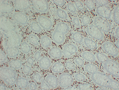Anti-p27 Kip 1 Mouse Monoclonal Antibody