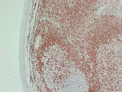 Anti-p27 Kip 1 Mouse Monoclonal Antibody