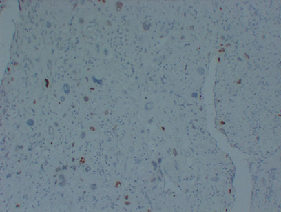 Anti-p57 Kip2 Mouse Monoclonal Antibody