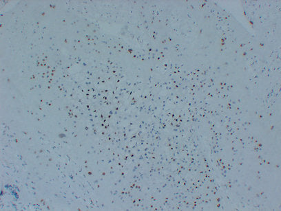 Anti-p57 Kip2 Mouse Monoclonal Antibody