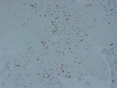 Anti-p57 Kip2 Mouse Monoclonal Antibody