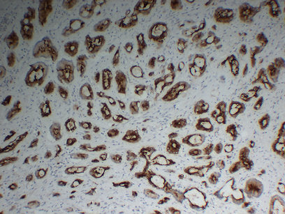 Anti-PSMA Mouse Monoclonal Antibody