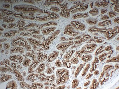 Anti-PSMA Mouse Monoclonal Antibody
