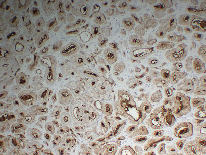 Anti-PSMA Mouse Monoclonal Antibody