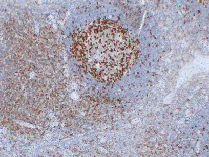 Anti-PD1 Mouse Monoclonal Antibody