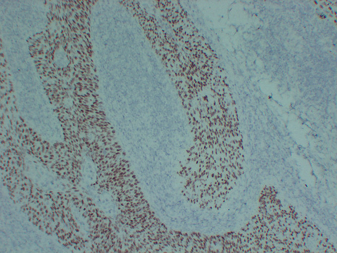Anti-p63 Mouse Monoclonal Antibody