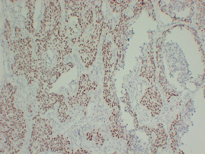 Anti-p63 Mouse Monoclonal Antibody