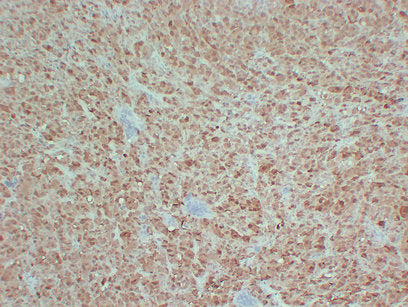 Anti-S100B Mouse Monoclonal Antibody