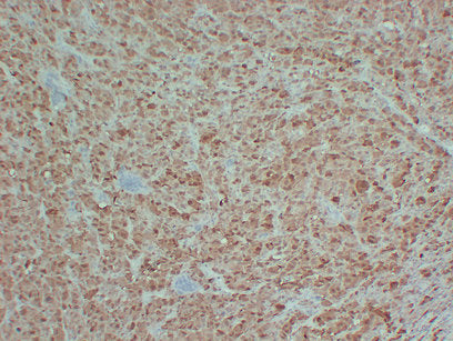 Anti-S100B Mouse Monoclonal Antibody