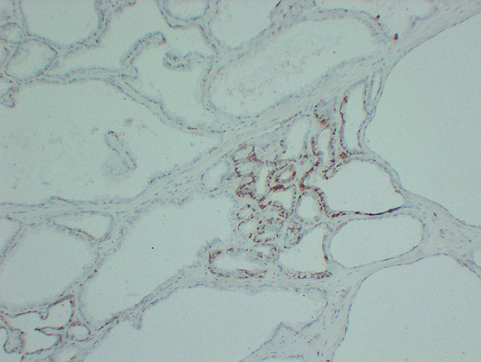 Anti-S100 alpha 6 Mouse Monoclonal Antibody