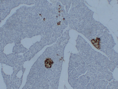Anti-Synaptophysin Mouse Monoclonal Antibody
