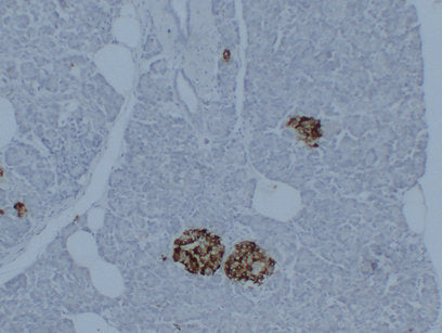 Anti-Synaptophysin Mouse Monoclonal Antibody