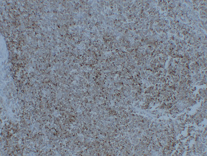 Anti-Synaptophysin Mouse Monoclonal Antibody