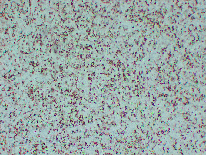 Anti-Stathmin 1 Mouse Monoclonal Antibody