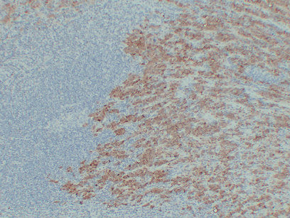 Anti-S100A1 Mouse Monoclonal Antibody