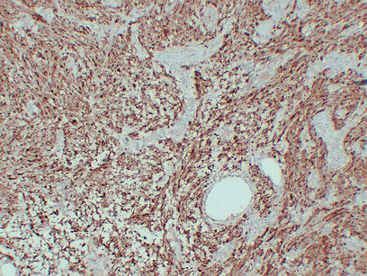 Anti-S100A1 Mouse Monoclonal Antibody